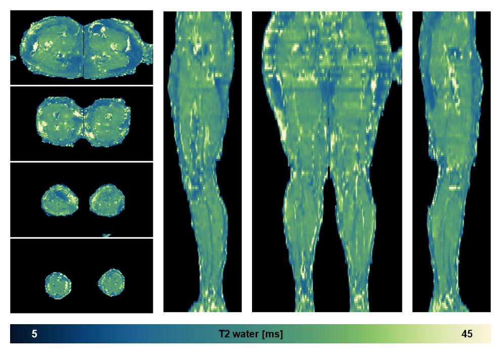 The water only T2 relaxation time of the lower extremity obtained from multi echo spin echo t2 mapping with EPG based reconstruction.